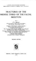 Fractures of the middle third of the facial skeleton