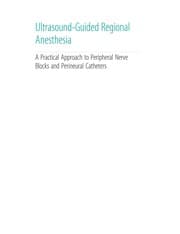 Ultrasound-guided regional anesthesia